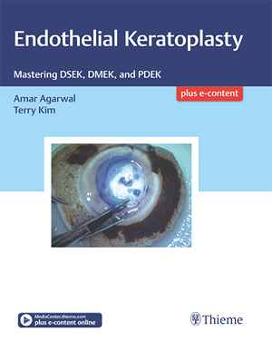 Endothelial Keratoplasty: Mastering DSEK, DMEK, and PDEK 1st