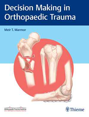 Decision Making in Orthopaedic Trauma 1st