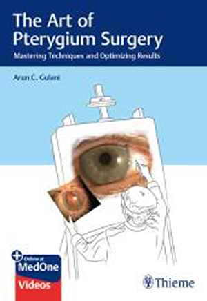The Art of Pterygium Surgery: Mastering Techniques and Optimizing Results 1st