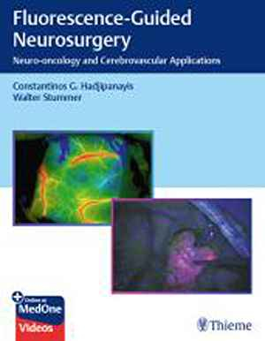 Fluorescence-Guided Neurosurgery: Neuro-oncology and Cerebrovascular Applications 1st