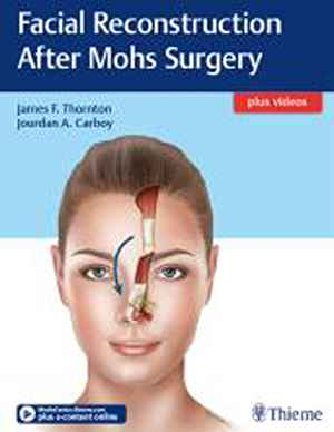 Facial Reconstruction After Mohs Surgery 1st