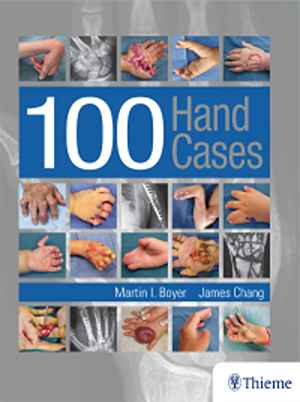100 Hand Cases 1st