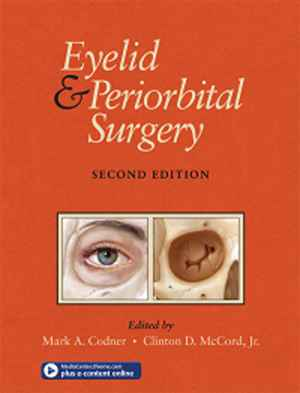 Eyelid and Periorbital Surgery 2nd