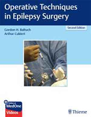 Operative Techniques in Epilepsy Surgery 2nd