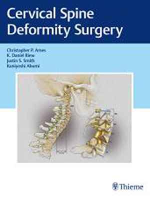 Cervical Spine Deformity Surgery 1st