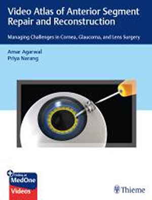 Video Atlas of Anterior Segment Repair and Reconstruction: Managing Challenges in Cornea, Glaucoma, and Lens Surgery 1st