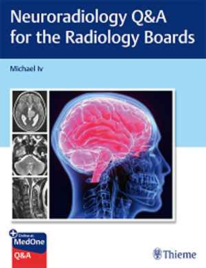Neuroradiology Q&A for the Radiology Boards 1st