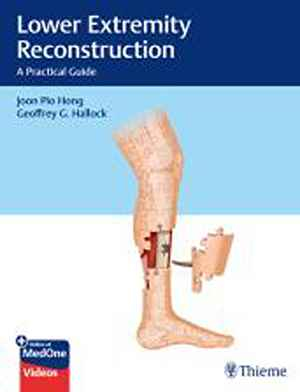 Lower Extremity Reconstruction: A Practical Guide 1st