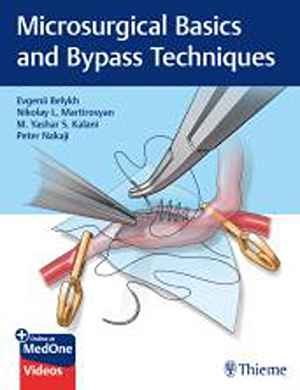 Microsurgical Basics and Bypass Techniques 1st