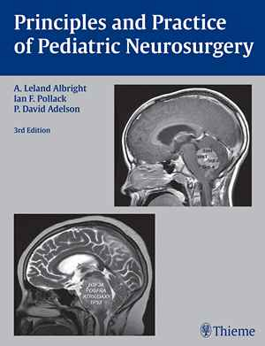 Principles and Practice of Pediatric Neurosurgery 3rd