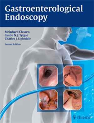Gastroenterological Endoscopy 2nd