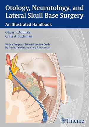 Otology, Neurotology, and Lateral Skull Base Surgery: An Illustrated Handbook 1st