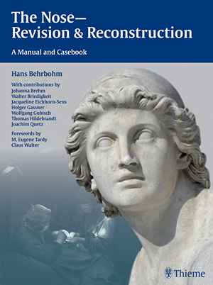 The Nose - Revision and Reconstruction: A Manual and Casebook 1st