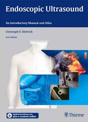 Endoscopic Ultrasound: An Introductory Manual and Atlas 2nd