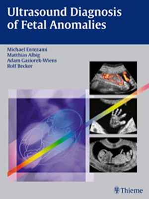 Ultrasound Diagnosis of Fetal Anomalies 1st