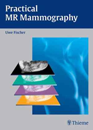 Practical MR Mammography 1st
