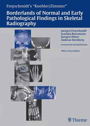 Freyschmidt's "Koehler/Zimmer" Borderlands of Normal and Early Pathological Findings in Skeletal Radiography 5th