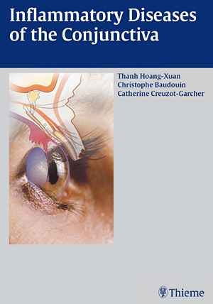Inflammatory Diseases of the Conjuctiva 1st