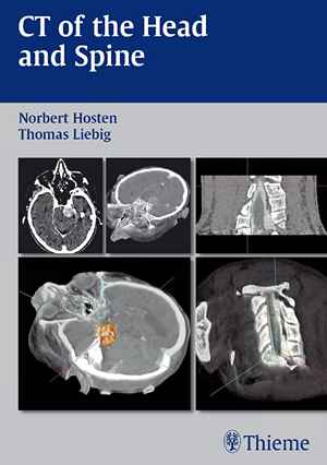 CT of the Head and Spine 1st