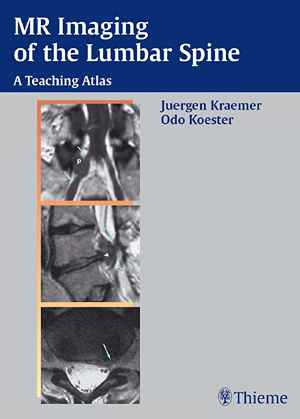 MR Imaging of the Lumbar Spine: A Teaching Atlas 1st