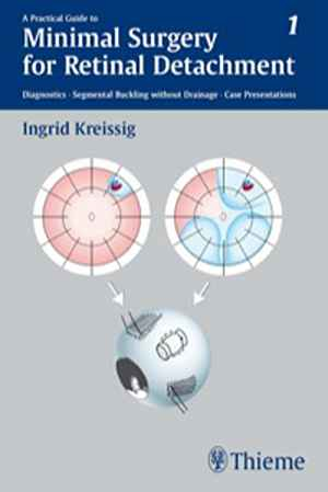 Practical Guide to Minimal Surgery for Retinal Detachment 1st