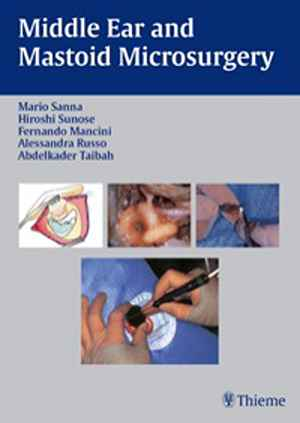 Middle Ear and Mastoid Microsurgery 1st
