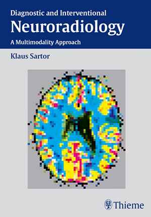 Diagnostic and Interventional Neuroradiology: A Multimodality Approach 1st