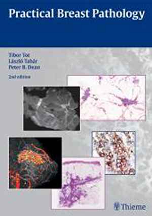 Practical Breast Pathology 2nd