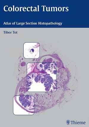 Colorectal Tumors: Atlas of Large Section Histopathology 1st