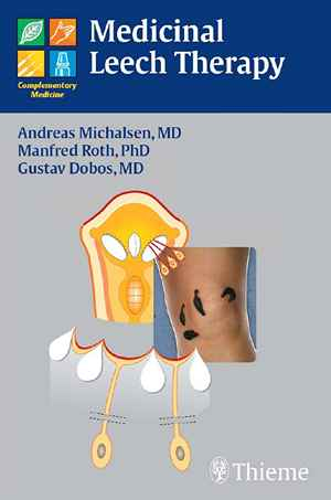 Medicinal Leech Therapy 1st