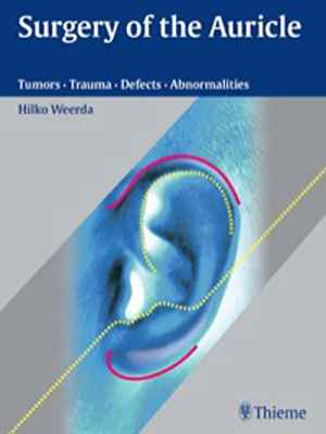 Surgery of the Auricle: Tumors-Trauma-Defects-Abnormalities 1st