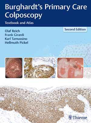 Burghardt's Primary Care Colposcopy: Textbook and Atlas 2nd