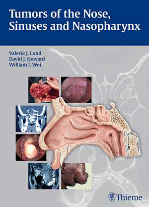 Tumors of the Nose, Sinuses and Nasopharynx 1st