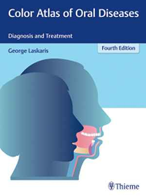 Color Atlas of Oral Diseases: Diagnosis and Treatment 4th