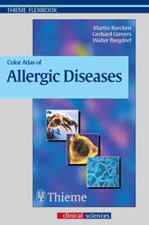 Color Atlas of Allergic Diseases 1st