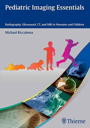 Pediatric Imaging Essentials: Radiography, Ultrasound, CT, and MRI in Neonates and Children 1st