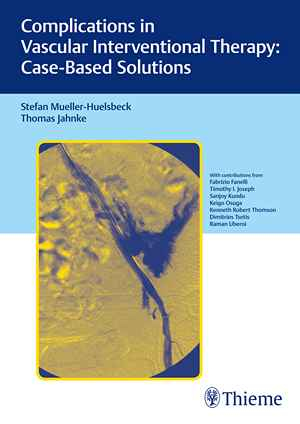 Complications in Vascular Interventional Therapy: Case-Based Solutions 1st