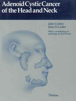 Adenoid cystic cancer of the head and neck