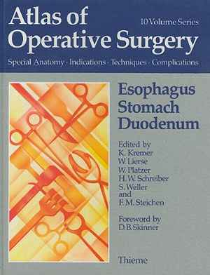 Esophagus, Stomach, Duodenum: Atlas of Operative Surgery: Surgical Anatomy, Indications, Techniques, Complications
