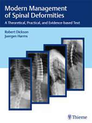 Modern Management of Spinal Deformities: A Theoretical, Practical, and Evidence-Based Text 1st