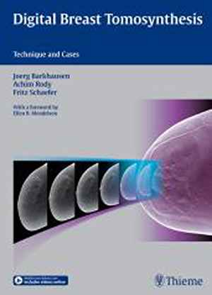 Digital Breast Tomosynthesis: Technique and Cases 1st
