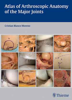 Atlas of Arthroscopic Anatomy of the Major Joints 1st