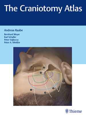 The Craniotomy Atlas 1st