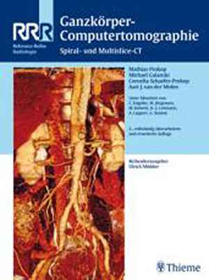 Ganzkörper-Computertomographie: Spiral- und Multislice-CT