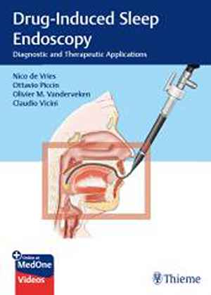 Drug-Induced Sleep Endoscopy: Diagnostic and Therapeutic Applications 1st