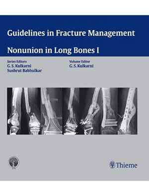 Guidelines in Fracture Management