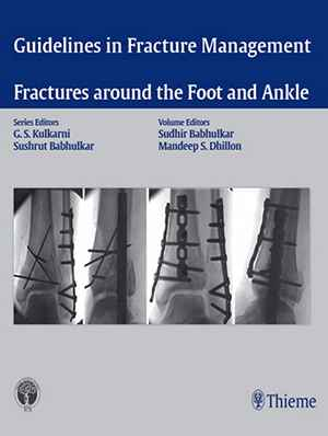 Guidelines in Fracture Management