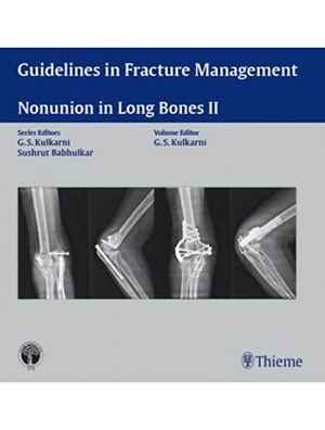 Guidelines in Fracture Management