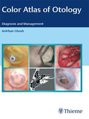 Color Atlas of Otology: Diagnosis and Management 1st