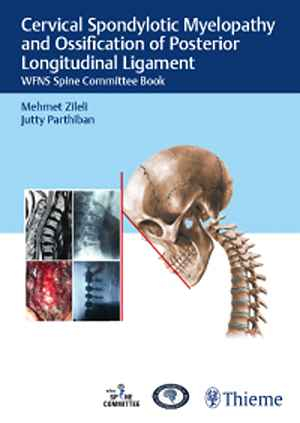 Cervical Spondylotic Myelopathy and Ossification of Posterior Longitudinal Ligament: WFNS Spine Committee Book 1st